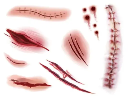 [5211] TATUAJE HERIDAS